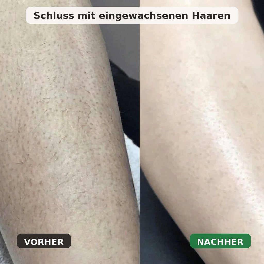 Glatte Haut - Ohne Rasurpickel, Brennen & eingewachsene Haare.